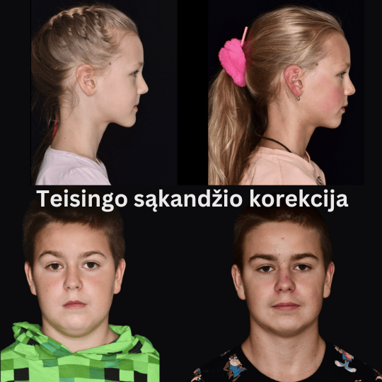 vaikų dantų eduonis karjesas