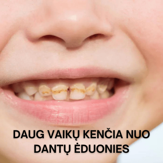 vaikų dantų eduonis karjesas